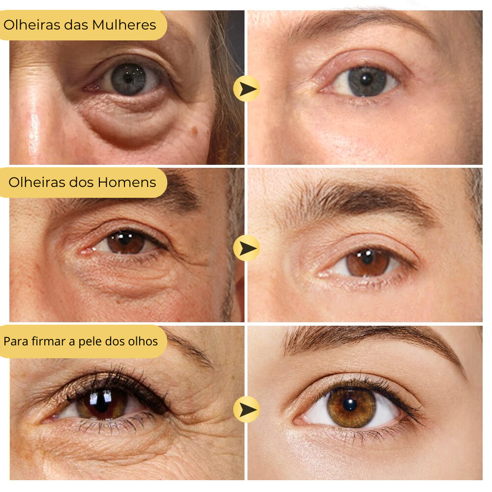 Creme Hidratante Antienvelhecimento - Removedor de Olheiras - unisex - Frete Grátis