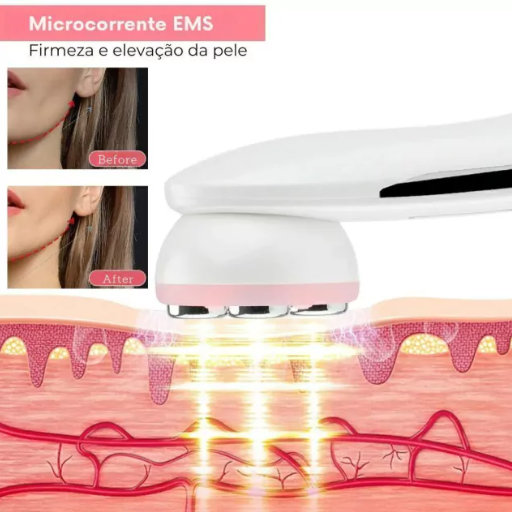 Máquina de Beleza Facial 5 em 1 - Instrumento de beleza para remoção de rugas por radiofreqência