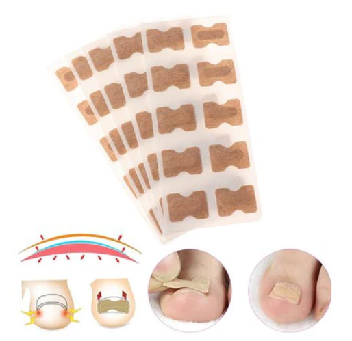 Kit De Tratamento De Correção De Unhas Encravada - Frete Grátis