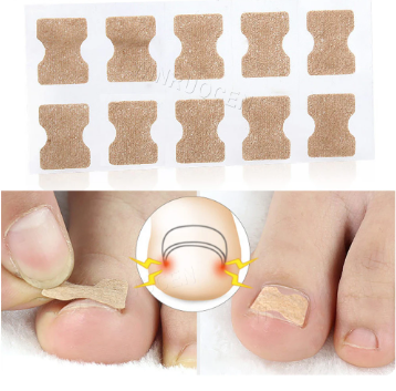 Kit De Tratamento De Correção De Unhas Encravada - Frete Grátis