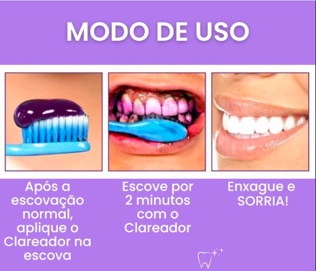 Clareador Dental Smile V34 - Dentes Brancos Em Segundos